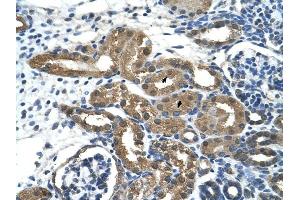 HDAC9 antibody was used for immunohistochemistry at a concentration of 2.
