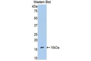 Western Blotting (WB) image for anti-Endoglin (ENG) (AA 26-136) antibody (ABIN1858716) (Endoglin anticorps  (AA 26-136))