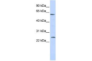 WB Suggested Anti-SLC18A1 Antibody Titration:  0. (SLC18A1 anticorps  (Middle Region))