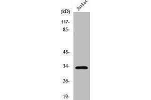 Western Blot analysis of Jurkat cells using Cleaved-Cathepsin A 32k (R326) Polyclonal Antibody (CTSA anticorps  (Cleaved-Arg326))