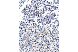 Immunohistochemical staining (Formalin-fixed paraffin-embedded sections) of human pancreas (A) and human liver (B) with CDX4 polyclonal antibody  at 4-8 ug/mL working concentration. (CDX4 anticorps  (C-Term))