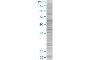 CDO1 transfected lysate. (CDO1 293T Cell Transient Overexpression Lysate(Denatured))