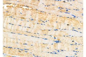 ABIN6264868 and ABIN6277492 at 1/100 staining Rat muscle tissue by IHC-P. (RRM2 anticorps  (C-Term))