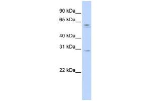 WB Suggested Anti-REC8 Antibody Titration:  0. (REC8 anticorps  (N-Term))