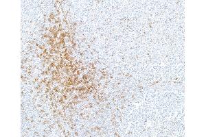 Immunohistochemistry (IHC) image for anti-CD5 (CD5) (AA 25-371) antibody (ABIN7449418)