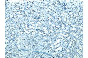 (ABIN184697) Negative Control showing staining of paraffin embedded Human Kidney, with no primary antibody. (STUB1 anticorps  (C-Term))