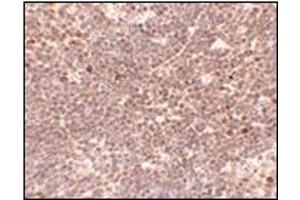 Immunohistochemistry of S1P1 in Mouse thymus tissue with EDG-1 / S1PR1 antibody at 5 μg/ml.
