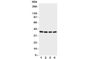 Western blot testing of EIF2B antibody and Lane 1:  M451;  2: Jurkat;  3: HeLa;  4: 293T cell lysate. (EIF2S2 anticorps  (C-Term))
