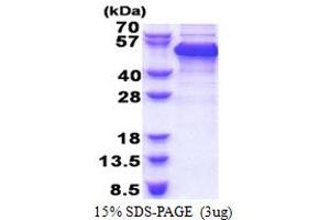 SDS-PAGE (SDS) image for RNA Binding Motif Protein 17 (RBM17) (AA 1-401) protein (His tag) (ABIN5853401)