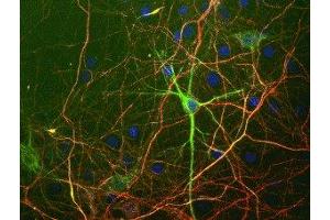 Immunostaining of cultured neurons and glia with anti-chicken neurofilament H antibody (red) and anti-mouse neurofilament L (green). (NEFH anticorps)