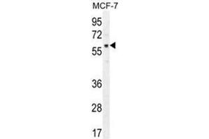 AKT1 Antibody (pT450) western blot analysis in MCF-7 cell line lysates (35 µg/lane). (AKT1 anticorps  (C-Term))