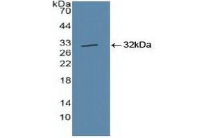 Detection of Recombinant CUL1, Human using Polyclonal Antibody to Cullin 1 (CUL1)