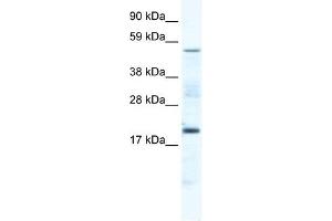 CSNK1G1 antibody (20R-1168) used at 0. (CSNK1G1 anticorps  (Middle Region))