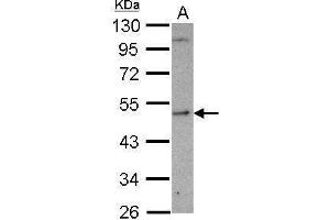 WB Image Sample (30 ug of whole cell lysate) A: U87-MG 10% SDS PAGE antibody diluted at 1:1000 (SHMT1 anticorps)