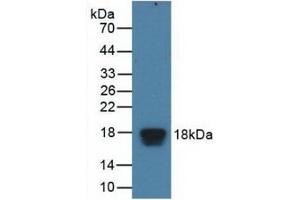 Detection of Recombinant EIF4EBP1, Human using Polyclonal Antibody to Eukaryotic Translation Initiation Factor 4E Binding Protein 1 (EIF4EBP1)