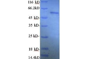 SDS-PAGE (SDS) image for Estrogen Receptor 2 (ESR2) (AA 2-530) protein (His tag) (ABIN5713440)