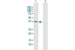 Western Blot analysis of ACVR2B expression in transfected 293T cell line by ACVR2B MaxPab polyclonal antibody.