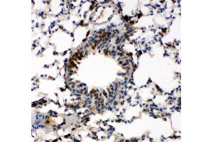 Anti-Caspase-6(P18) antibody,  IHC(P) IHC(P): Mouse Lung Tissue