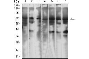 Western blot analysis using GPC3 mouse mAb against SW480 (1), HCT116 (2), SH-SY5Y (3), HepG2 (4), PC-12 (5), HEK293 (6), and Hela (7) cell lysate. (Glypican 3 anticorps  (AA 359-554))