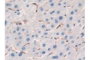 Detection of CFL1 in Human Liver Tissue using Polyclonal Antibody to Cofilin 1 (CFL1)