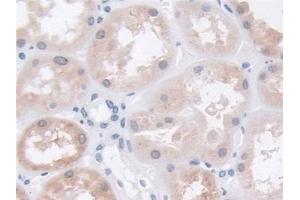 Detection of TPP1 in Human Kidney Tissue using Polyclonal Antibody to Tripeptidyl Peptidase I (TPP1)