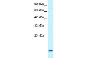 WB Suggested Anti-UBE2N Antibody Titration:  1. (UBE2N anticorps  (Middle Region))
