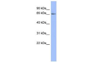 WB Suggested Anti-ZNF329 Antibody Titration:  0. (ZNF329 anticorps  (Middle Region))