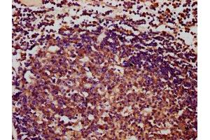 IHC image of ABIN7166787 diluted at 1:400 and staining in paraffin-embedded human lymph node tissue performed on a Leica BondTM system.
