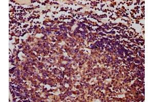 IHC image of ABIN7166787 diluted at 1:400 and staining in paraffin-embedded human lymph node tissue performed on a Leica BondTM system. (IBA57 anticorps  (AA 286-356))