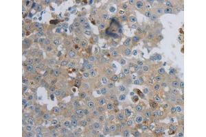 Immunohistochemistry (IHC) image for anti-Creatine Kinase, Mitochondrial 1A (CKMT1A) antibody (ABIN5546002) (CKMT1A anticorps)
