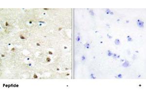 Immunohistochemistry analysis of paraffin-embedded human brain tissue using HNRNPC polyclonal antibody . (HNRNPC anticorps)