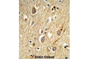 Immunohistochemistry (IHC) image for anti-RAB8A, Member RAS Oncogene Family (RAB8A) antibody (ABIN3003984)