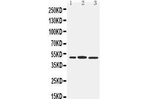 Anti-IRF8 antibody, Western blotting Lane 1: RAJI Cell Lysate Lane 2: Rat Liver Tissue Lysate Lane 3: Rat Kidney Tissue Lysate (IRF8 anticorps  (C-Term))