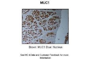 Sample Type :  Pig stomach  Primary Antibody Dilution :  1:5000 + 1:2000  Secondary Antibody :  Anti-rabbit-HRP  Secondary Antibody Dilution :  1:1000  Color/Signal Descriptions :  Brown: MUC1 Blue: Nucleus  Gene Name :  MUC1  Submitted by :  Dr.