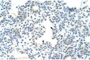 Immunohistochemical staining (Formalin-fixed paraffin-embedded sections) of human lung with HOXC10 polyclonal antibody  at 4-8 ug/mL working concentration. (HOXC10 anticorps  (N-Term))
