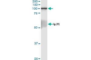 Immunoprecipitation of RAPGEF3 transfected lysate using anti-RAPGEF3 MaxPab rabbit polyclonal antibody and Protein A Magnetic Bead , and immunoblotted with RAPGEF3 MaxPab rabbit polyclonal antibody (D01) . (RAPGEF3 anticorps  (AA 1-881))