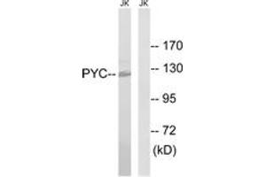 Western blot analysis of extracts from Jurkat cells, using PC Antibody. (PC (AA 357-406) anticorps)