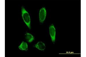 Immunofluorescence of purified MaxPab antibody to PLOD2 on HeLa cell. (PLOD2 anticorps  (AA 1-758))