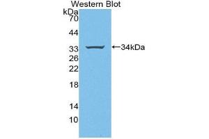 Western Blotting (WB) image for anti-Signal Transducing Adaptor Molecule (SH3 Domain and ITAM Motif) 1 (STAM) (AA 196-465) antibody (ABIN3206391) (STAM anticorps  (AA 196-465))