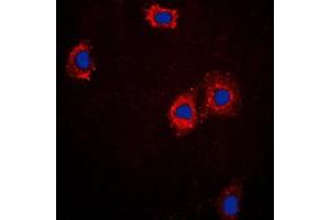 Immunofluorescent analysis of cTnI staining in A431 cells. (TNNI3 anticorps  (Center))