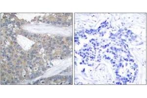 Immunohistochemistry (IHC) image for anti-Paxillin (PXN) (AA 15-64) antibody (ABIN2889052) (Paxillin anticorps  (AA 15-64))
