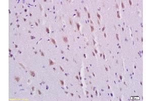Formalin-fixed and paraffin embedded rat brain labeled with Rabbit Anti-PDGFBB Polyclonal Antibody, Unconjugated  at 1:200 followed by conjugation to the secondary antibody and DAB staining (PDGF-BB Homodimer (AA 151-241) anticorps)