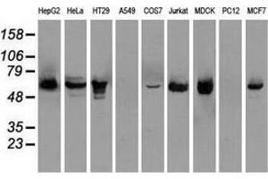 Western blot analysis of extracts (35 µg) from 9 different cell lines by using anti-CHEK2 monoclonal antibody. (CHEK2 anticorps)
