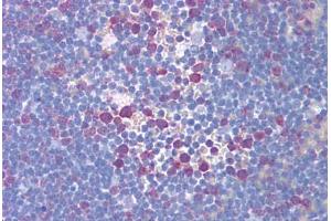 Human Thymus (formalin-fixed, paraffin-embedded) stained with TYMS antibody ABIN293172 at 5 ug/ml followed by biotinylated secondary antibody, alkaline phosphatase-streptavidin and chromogen. (TYMS anticorps)