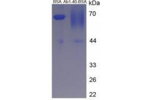 Amyloid beta 1-40 (Abeta 1-40) peptide (BSA)