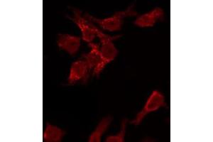 ABIN6267474 staining HeLa by IF/ICC. (AKT1 anticorps  (pSer473))