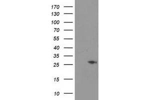 Western Blotting (WB) image for anti-Cyclin-Dependent Kinase Inhibitor 3 (CDKN3) antibody (ABIN1497462) (CDKN3 anticorps)