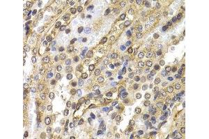 Immunohistochemistry of paraffin-embedded Rat kidney using NEDD9 Polyclonal Antibody at dilution of 1:200 (40x lens).