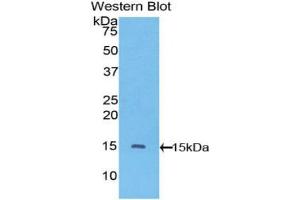 Western blot analysis of the recombinant protein. (VEGFC anticorps  (AA 108-223))