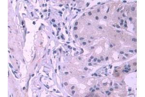 DAB staining on IHC-P; Samples: Human Stomach Tissue (PES1 anticorps  (AA 1-415))